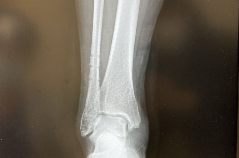 0154560D-FD74-4DCD-BDDF-9CB6C4156265