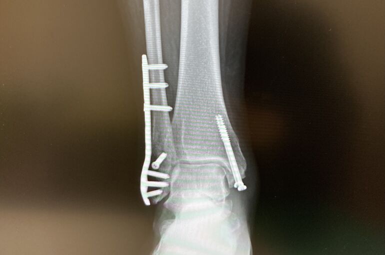 2644B70A-482D-420E-AED8-3DD86FE332A6