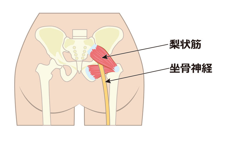イラストＡＣ梨状筋