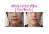 セルキュア４ｔプラスyukiko
