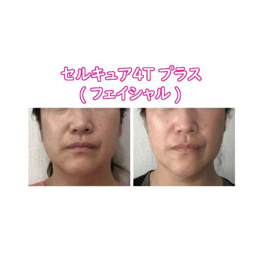セルキュア４ｔプラスyukiko