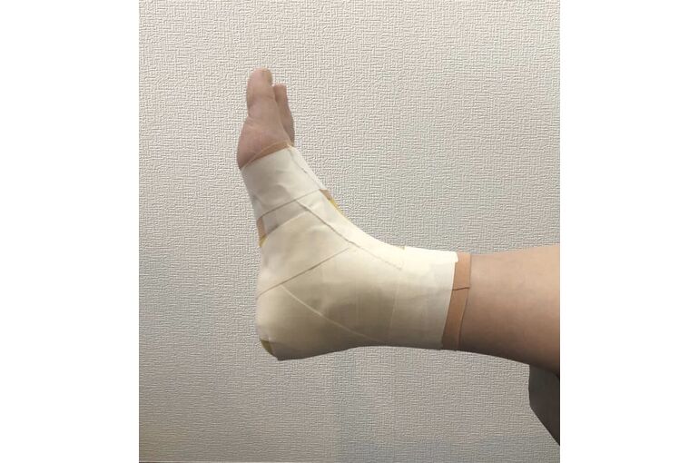 テーピング