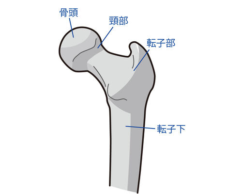イラストAC大腿骨