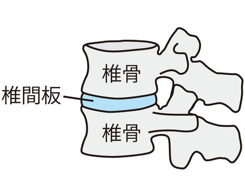 イラストAC椎間板