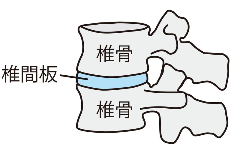 イラストAC椎間板