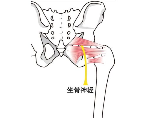 イラストAC坐骨神経